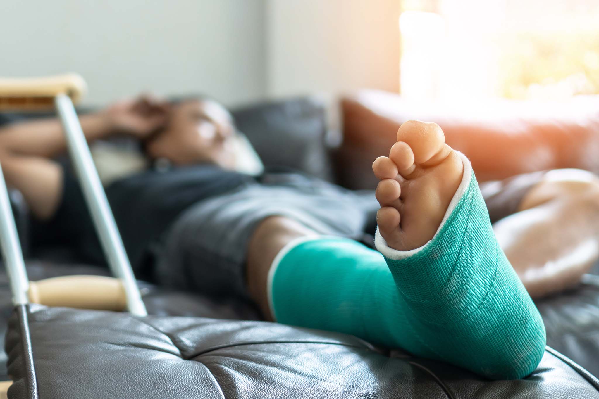 man laying on couch with injured leg in cast
